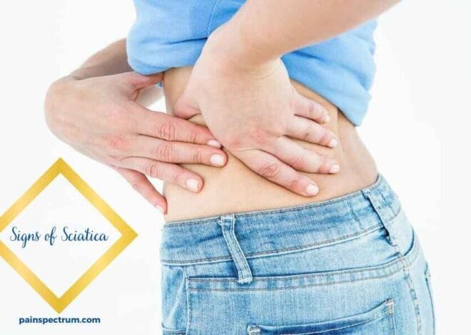 Signs of Sciatica | Best Guide 2024