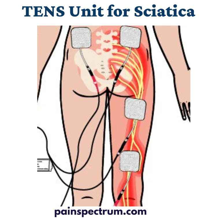 TENS Unit for Sciatica
