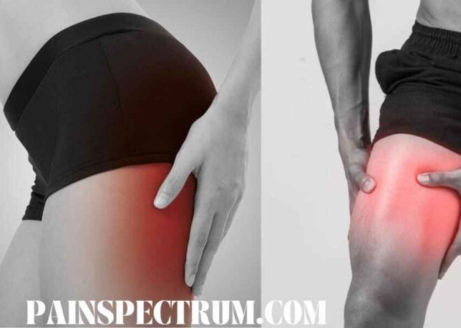 Managing Sciatica and Knee Pain: 9 Surprising Facts