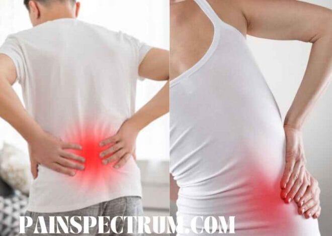 9 Best Treatment Options for Sciatica Pain