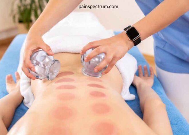 Cupping therapy for Sciatica: best Guide to Relief -2024