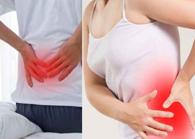 Immediate Sciatica Pain Relief: Best Home Remedies, Medical Options, 5 Exercises