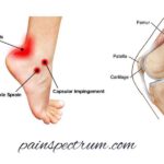 knee-and-ankle-pain